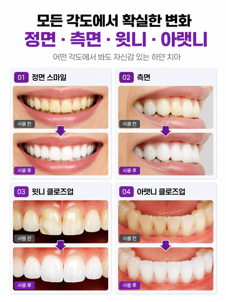 스타 다이아 나노 미백 치약