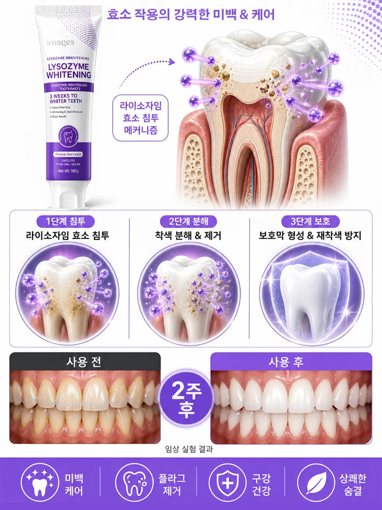 스타 다이아 나노 미백 치약