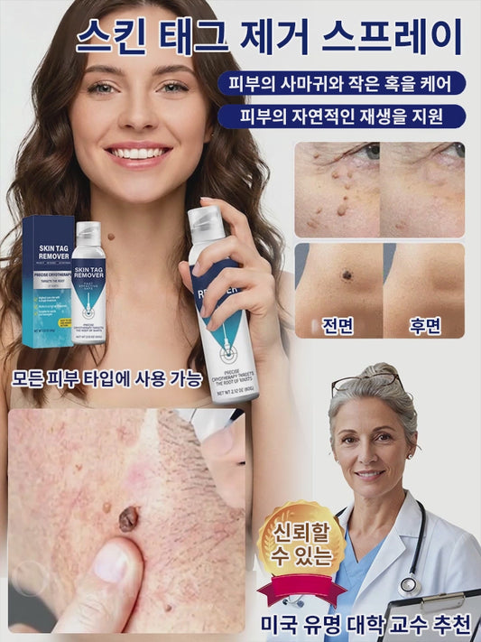 사마귀 완화 케어 스프레이